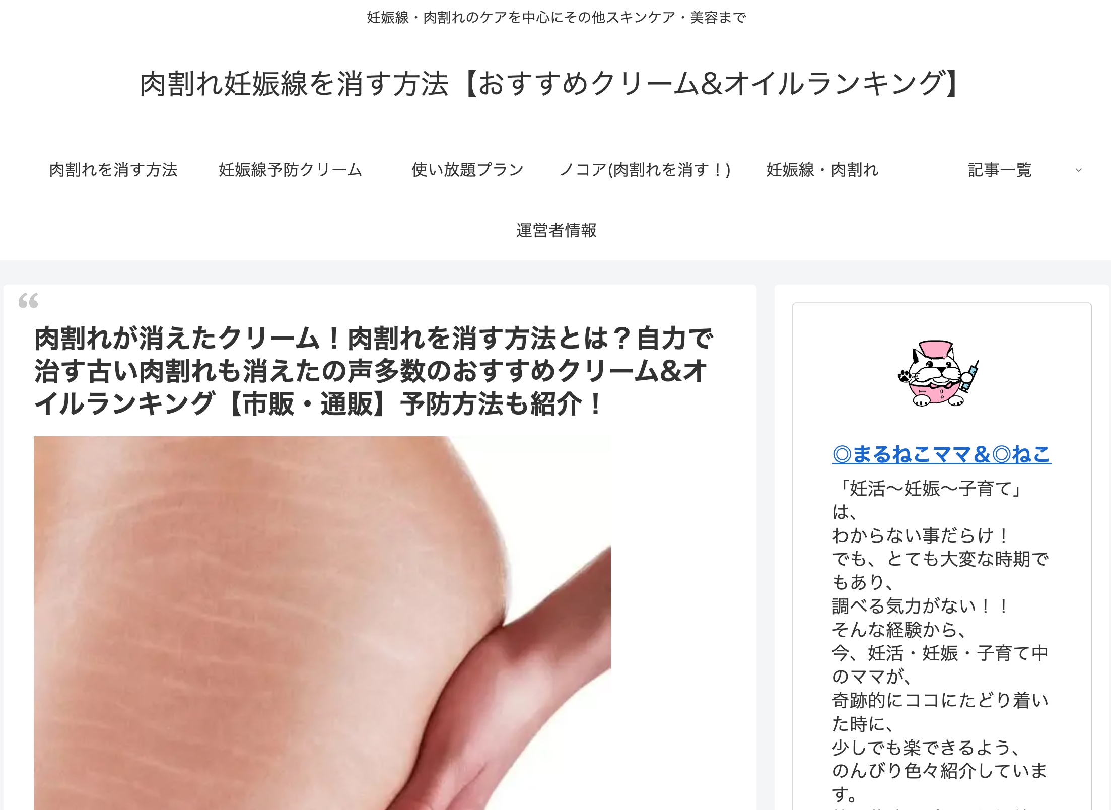 肉割れ妊娠線を消す方法【おすすめクリーム&オイルランキング】への称賛